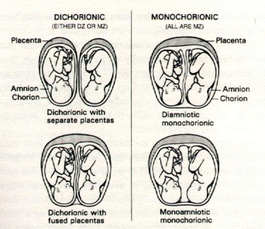 Types Of Twins Chart